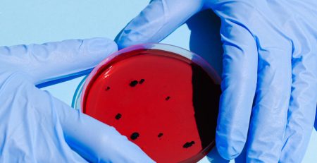 person holding petri dish 3786217 scaled 1